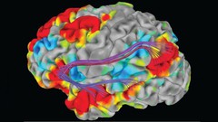  -  Basic Neuroanatomy for the Non-Neurologists 